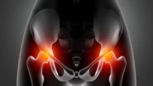 hip procedures - hip replaceemnt treatment