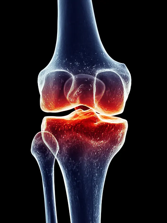 Knee Strengthening Exercises for Knee Pain
