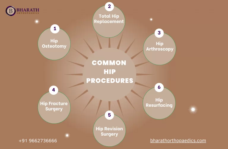 Hip Procedures in Chennai | Bharath Orthopaedics