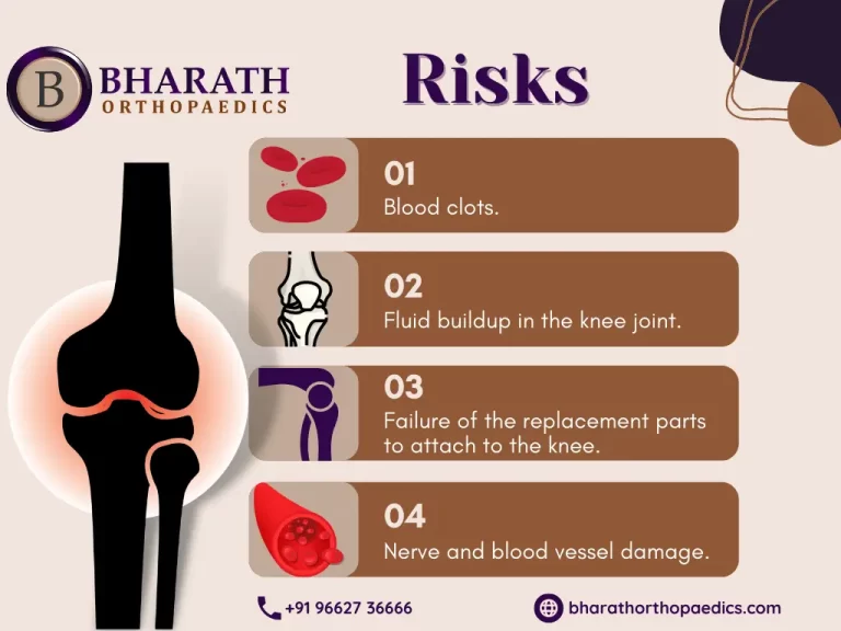 Partial Knee Replacement Surgery | Bharath Orthopaedics