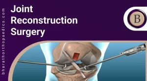 Joint Reconstruction Surgery | Bharath Orthopaedics