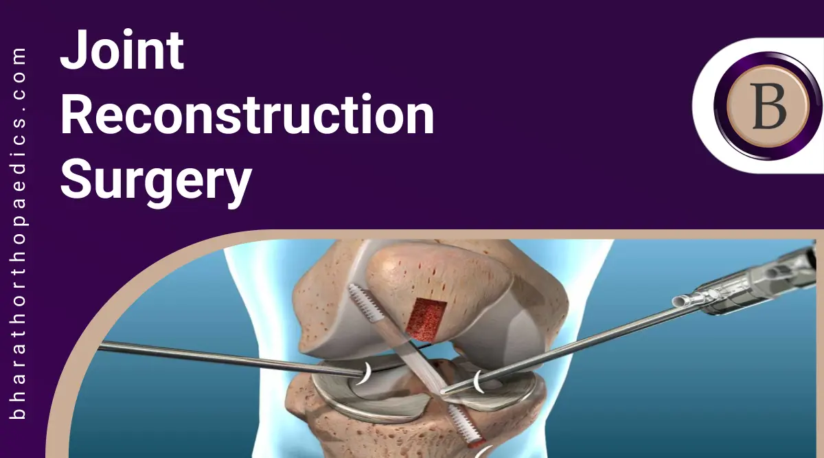 Joint Reconstruction Surgery