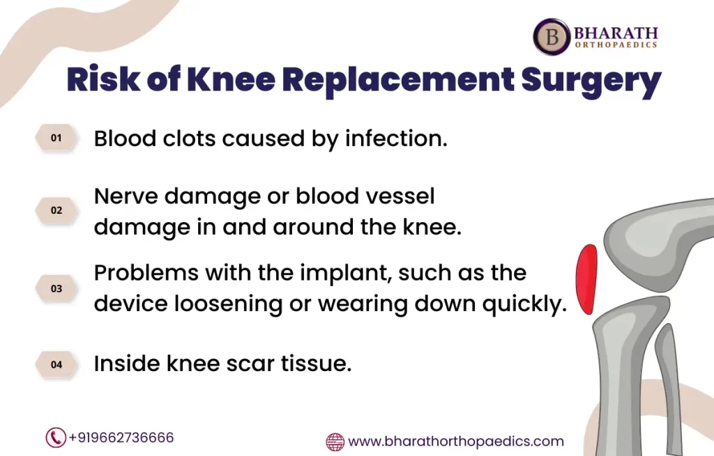 Knee Replacement Surgeons in Chennai | Bharath Orthopaedics