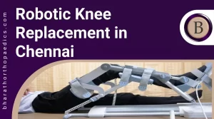 Robotic Knee Replacement in Chennai | Bharath Orthopaedics