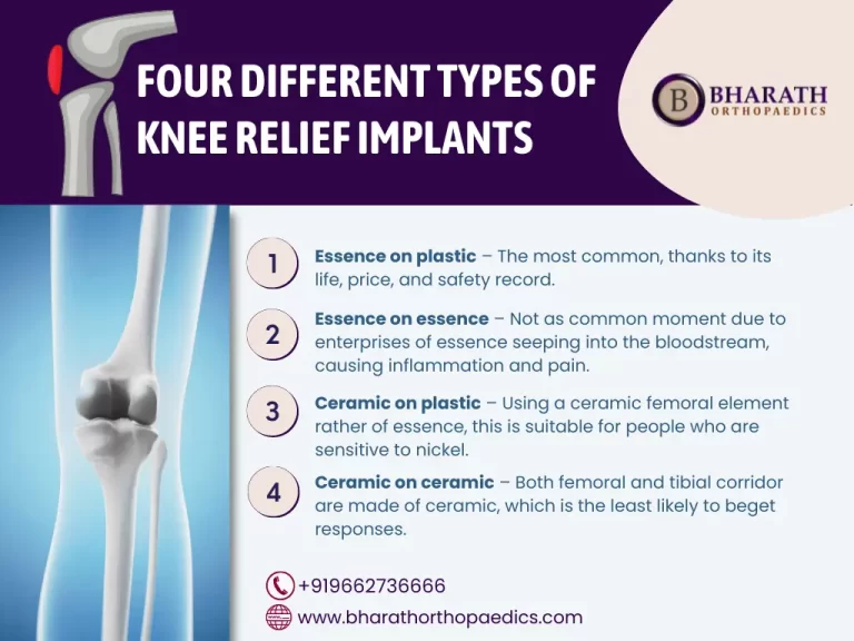 knee replacement surgery in chennai | Bharath Orthopaedics