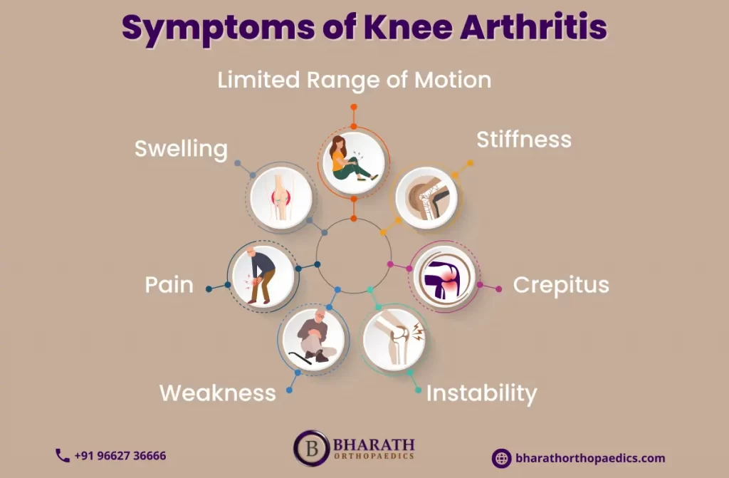 Can You Remove Arthritis | Bharath Orthopaedics