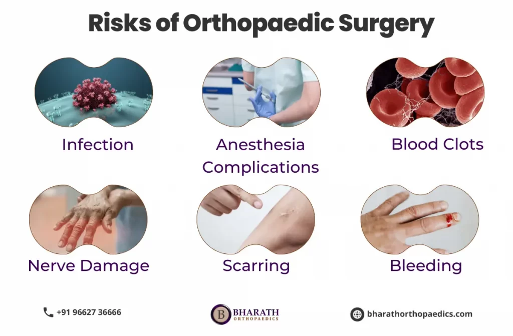 Orthopaedic Surgeon in India | Bharath Orthopaedics