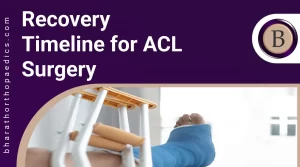 Recovery Timeline for ACL Surgery | Bharath Orthopaedics