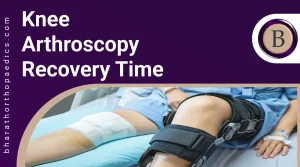 Knee Arthroscopy Recovery Time | Bharath Orthopaedics