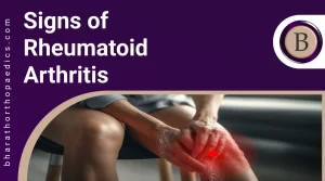 Signs of Rheumatoid Arthritis | Bharath Orthopaedics