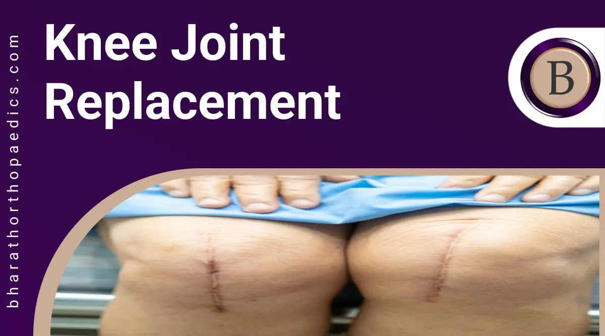 Knee Joint Replacement | Bharath Orthopaedics