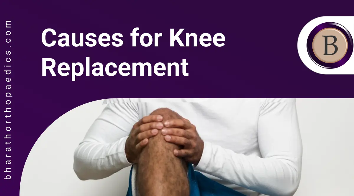 Causes for Knee Replacement