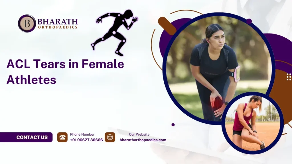 ALC tears in female athletes
