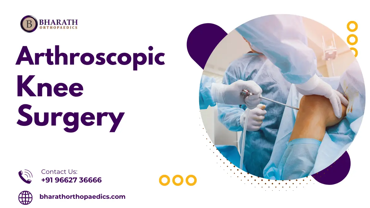 Arthroscopy Knee Surgery