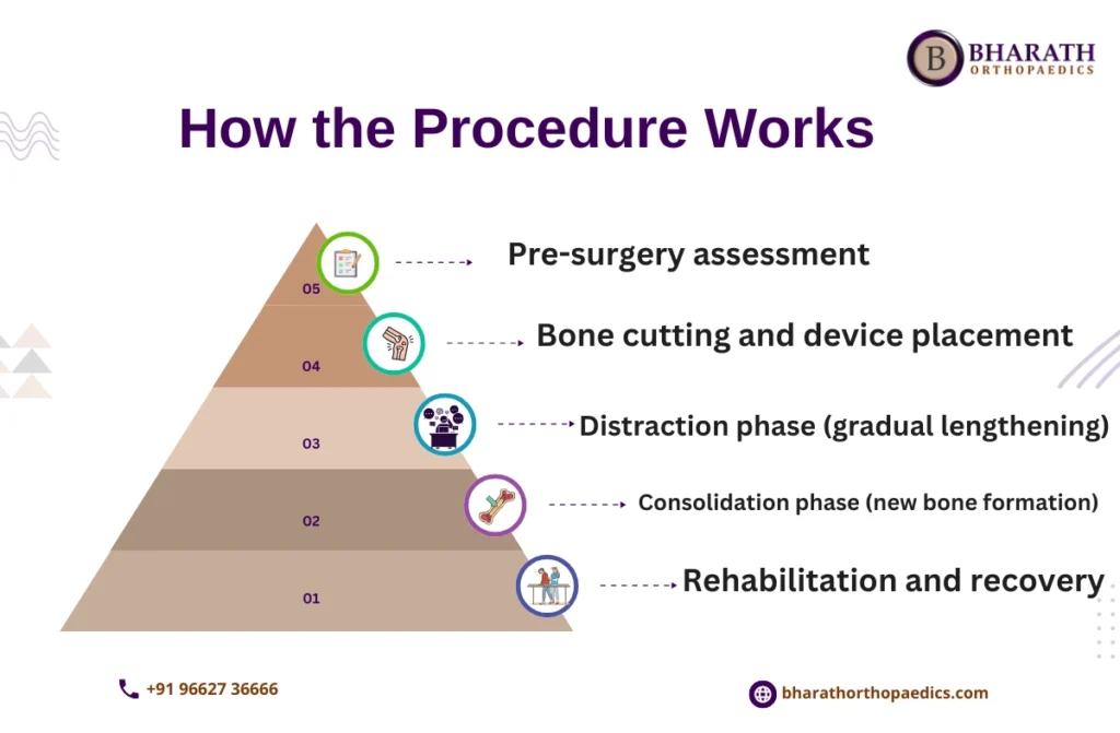 Limb Lengthening Surgery in Chennai