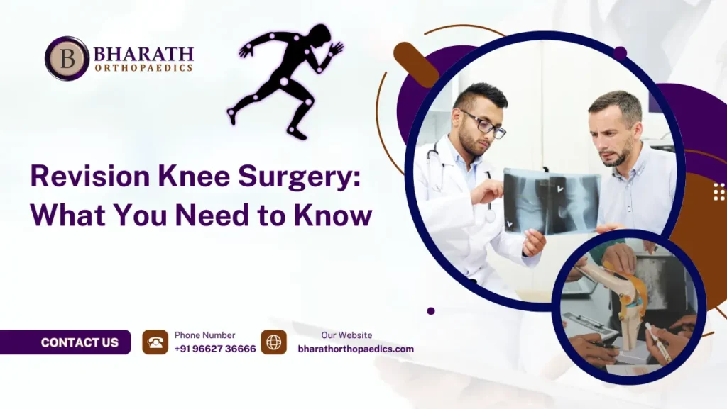 Revision Knee Surgery: What You Need to Know